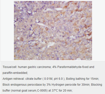 6052af38a426f.png image.png