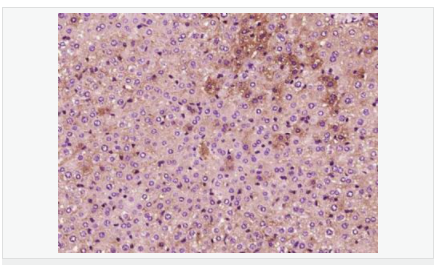 605850ac7824f.png image.png