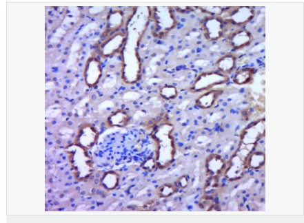 605855e8edef7.png image.png