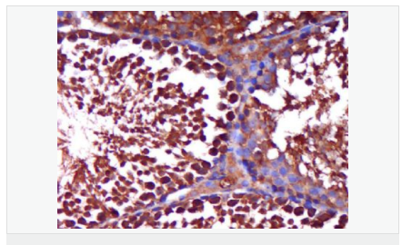 605958c8905dc.png image.png