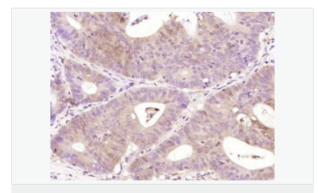 6066d30e1e168.png image.png